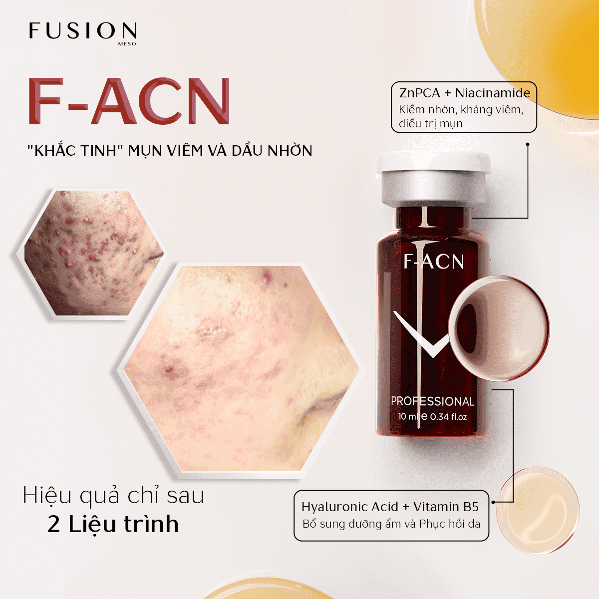 Meso FUSION F-ACN giảm mụn, thâm và ngăn chặn mụn - Thumbnail 5