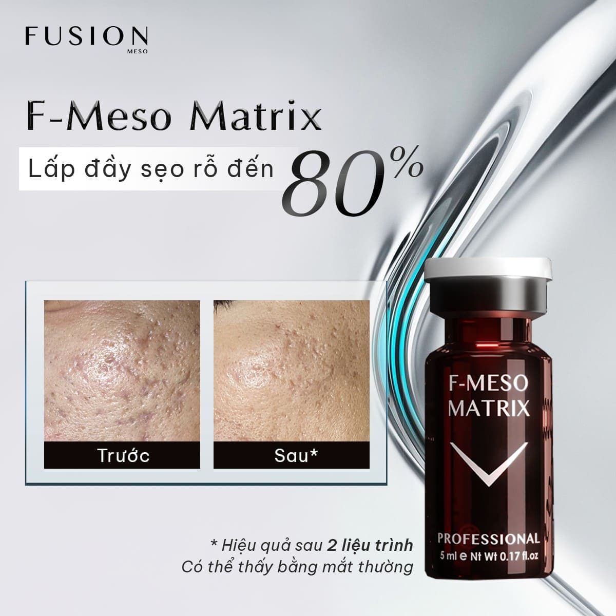 Meso FUSION F-MESOMATRIX giải quyết dứt điểm sẹo rỗ - Thumbnail 5